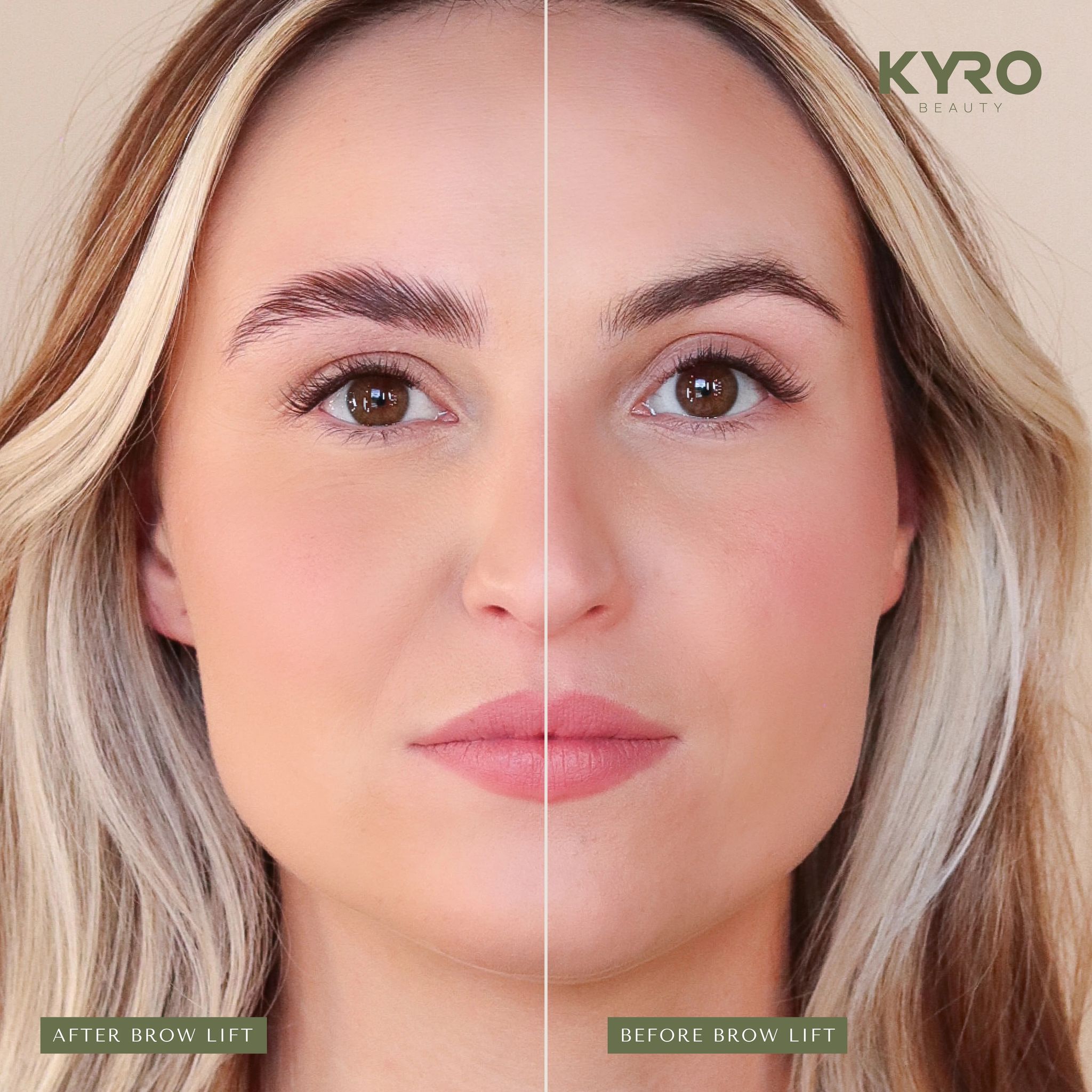 Expert Guide to Choosing a Lash Lift Kit for Home Use