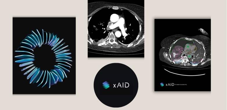 How Local Clinics Can Upgrade Medical Imaging With AI